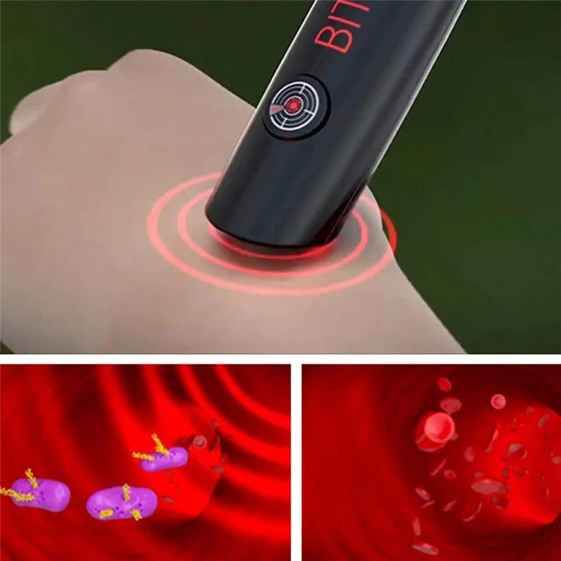 Mosquito Antipruritic Device Bite Soothes and Reduces Swelling Universal Adult Children Essential for Outdoor Camping Summer