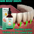 Rapid Repair Gum Serum – Effective Tooth Pain Relief, Anti-Sensitivity, Stain Removal, Anti-Cavity Protection, Teeth Whitening & Gum Care Essence 30ML
