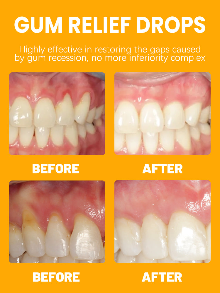 Rapid Repair Gum Serum – Effective Tooth Pain Relief, Anti-Sensitivity, Stain Removal, Anti-Cavity Protection, Teeth Whitening & Gum Care Essence 30ML
