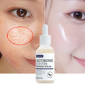 Lactobionic Acid Face Serum Pore Shrink Hyaluronic Acid Moisturizing Nourishing Firming Brighten Beauty Salicylic Acid Serum – Anti-Acne Face Serum & Dark Spot Correcting Serum for Glowing Skin | Acne Skin Care Products 30ml